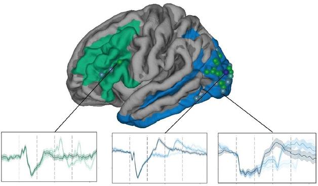 Map of the brain, plus graphs of brain activity