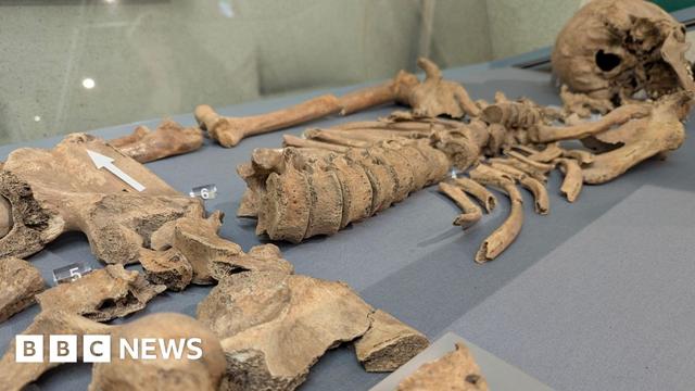Parts of a man's skeleton laid out on a blue cloth. There is an arrow pointing to a section of the hip bone where the bite marks were found.