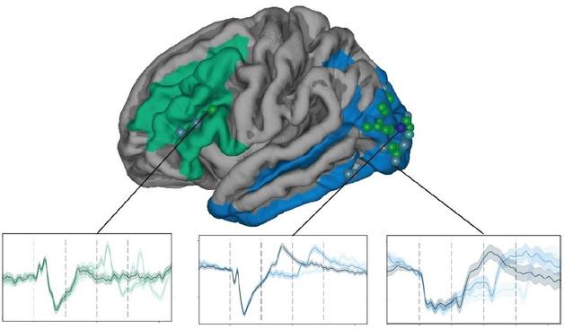Map of the brain, plus charts of brain activity